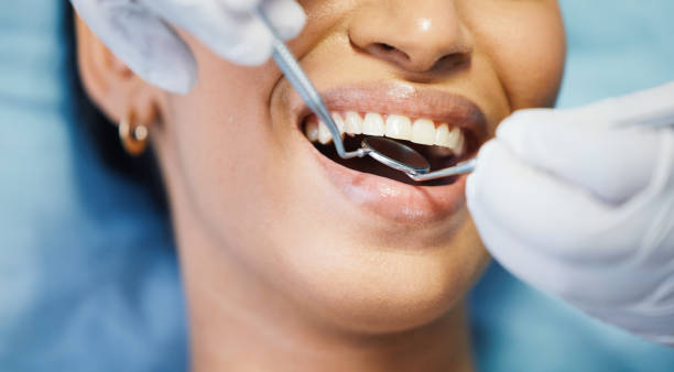 Best Urgent Care for Lost Fillings or Crowns in Flanders, NY